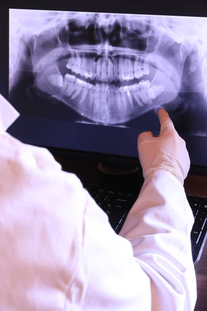 Best Emergency Root Canal Treatment in Butte, AK